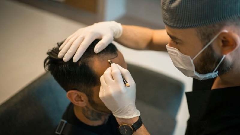 hair transplant services write for us