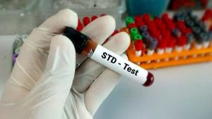 STD testing and treatments write for us